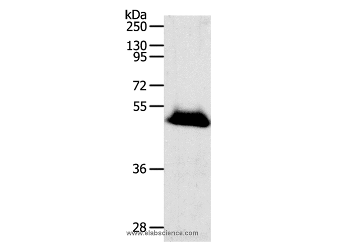 Western Blot analysis of Human liver cancer tissue using RBMS3 Polyclonal Antibody at dilution of 1:1000