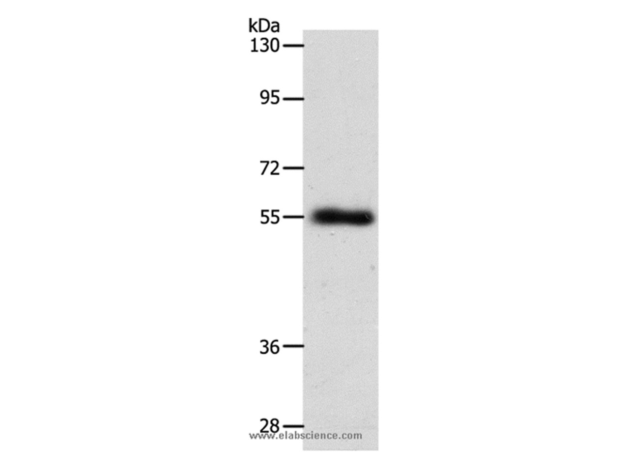Western Blot analysis of Mouse lung tissue using SLC1A5 Polyclonal Antibody at dilution of 1:600