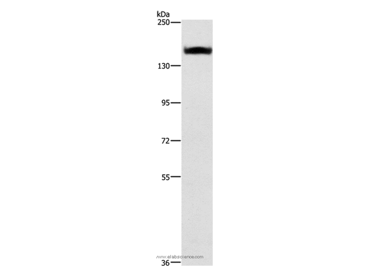 Western Blot analysis of A431 cell using ITGA2 Polyclonal Antibody at dilution of 1:300