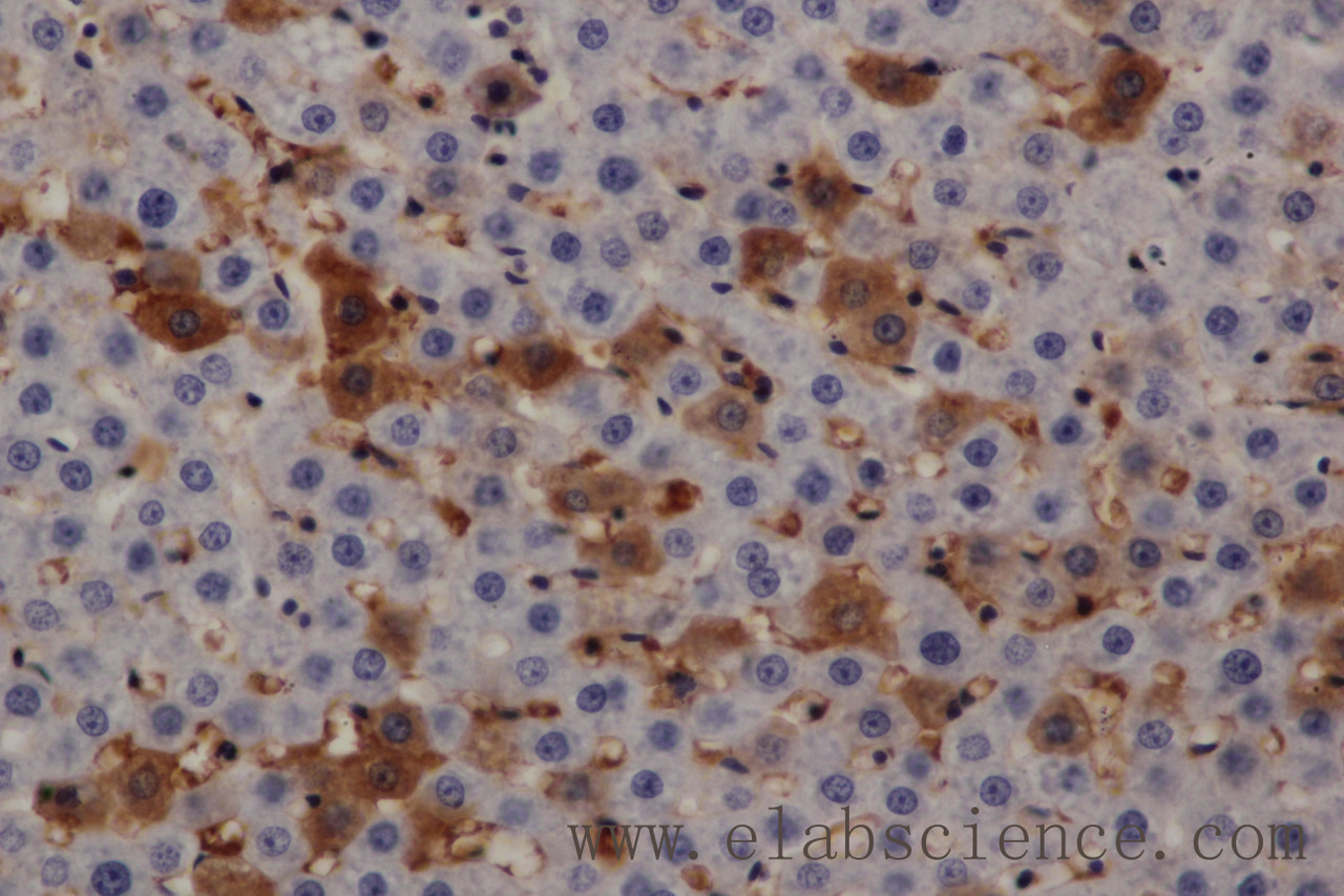 Immunohistochemistry of paraffin-embedded Rat liver using PRKD3 Polyclonal Antibody at dilution of 1:200