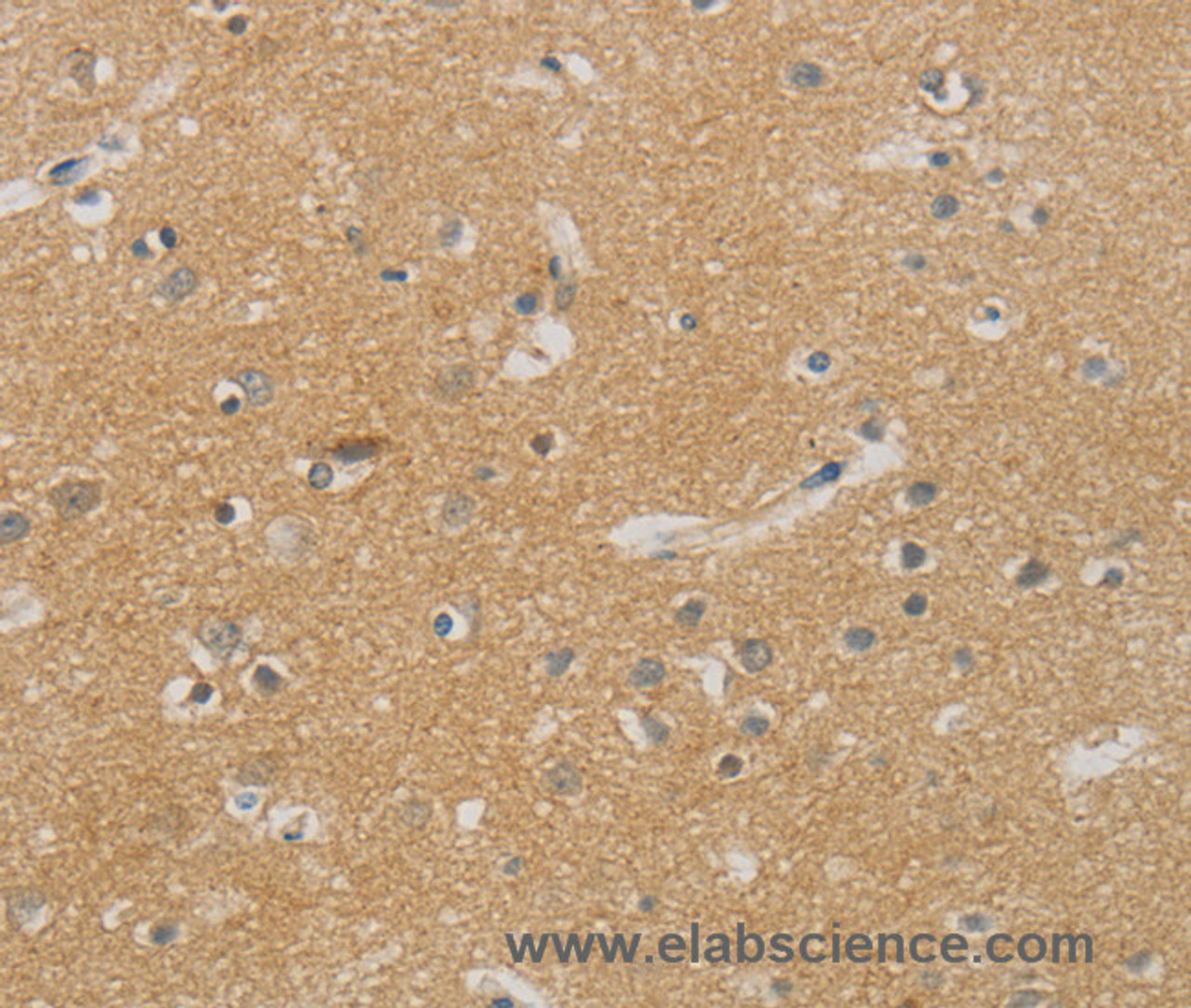 Immunohistochemistry of paraffin-embedded Human brain using NDRG1 Polyclonal Antibody at dilution of 1:70