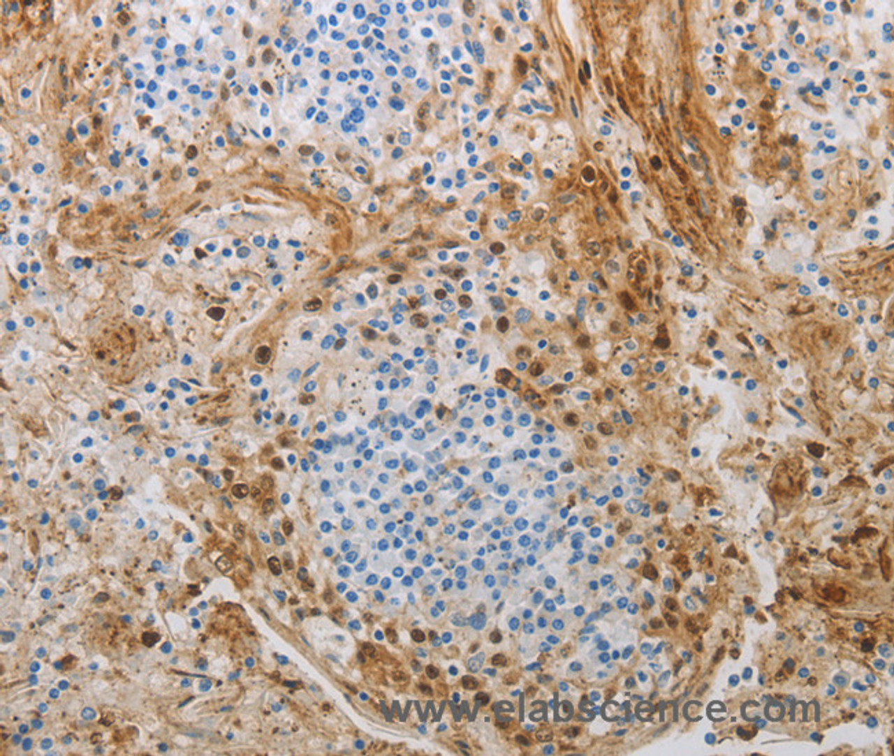 Immunohistochemistry of paraffin-embedded Human tonsil using NGFR Polyclonal Antibody at dilution of 1:50
