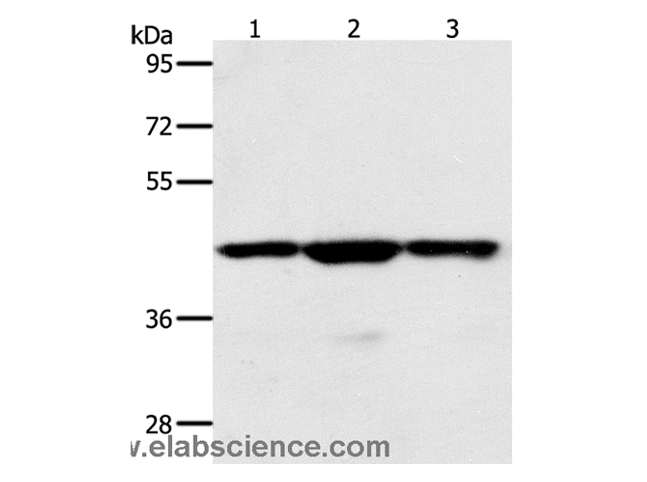 Western Blot analysis of Jurkat, hela and K562 cell using MAP2K1 Polyclonal Antibody at dilution of 1:400