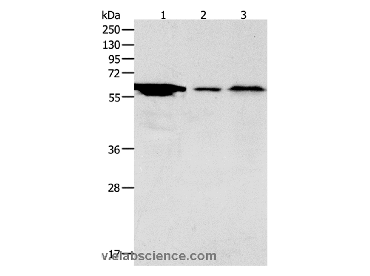 Western Blot analysis of Hela cell, Mouse stomach and brain tissue using ADCYAP1R1 Polyclonal Antibody at dilution of 1:2000