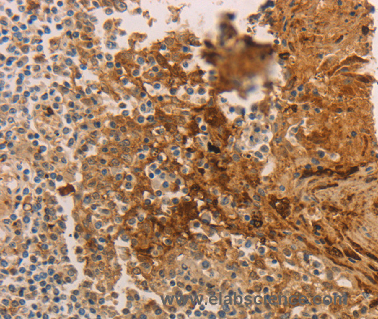 Immunohistochemistry of paraffin-embedded Human tonsil using ADCYAP1R1 Polyclonal Antibody at dilution of 1:70