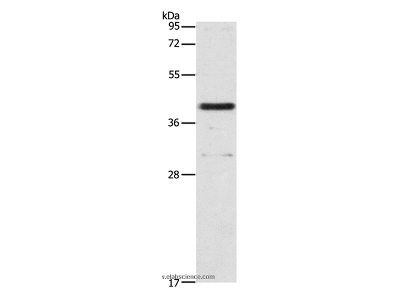Western Blot analysis of 231 cell using PAFAH2 Polyclonal Antibody at dilution of 1:700