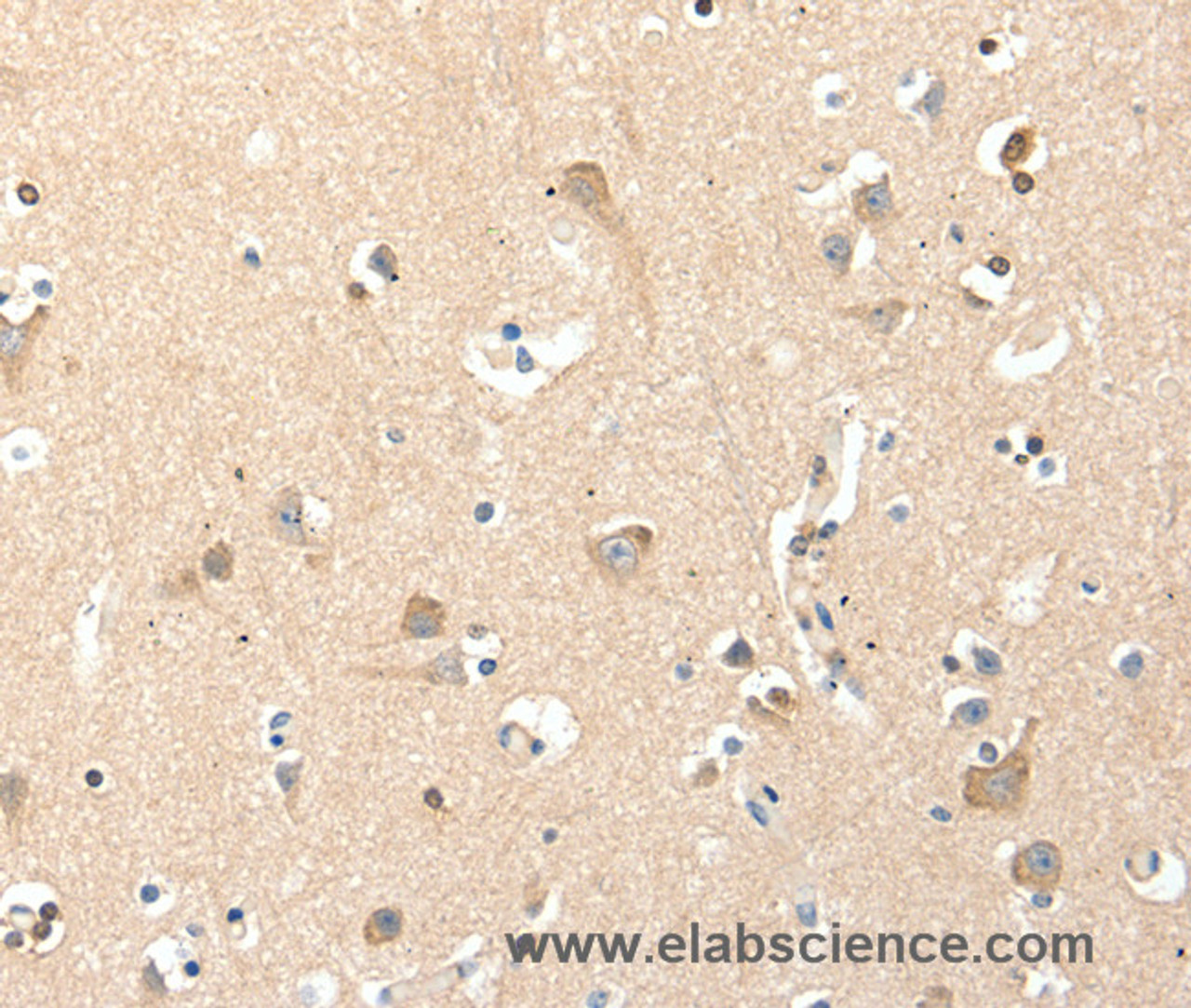 Immunohistochemistry of paraffin-embedded Human brain tissue using RRAD Polyclonal Antibody at dilution 1:50