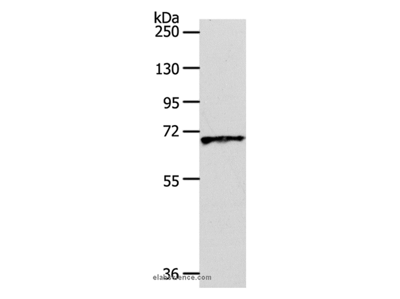 Western Blot analysis of Human liver cancer tissue using Oct-3 Polyclonal Antibody at dilution of 1:600