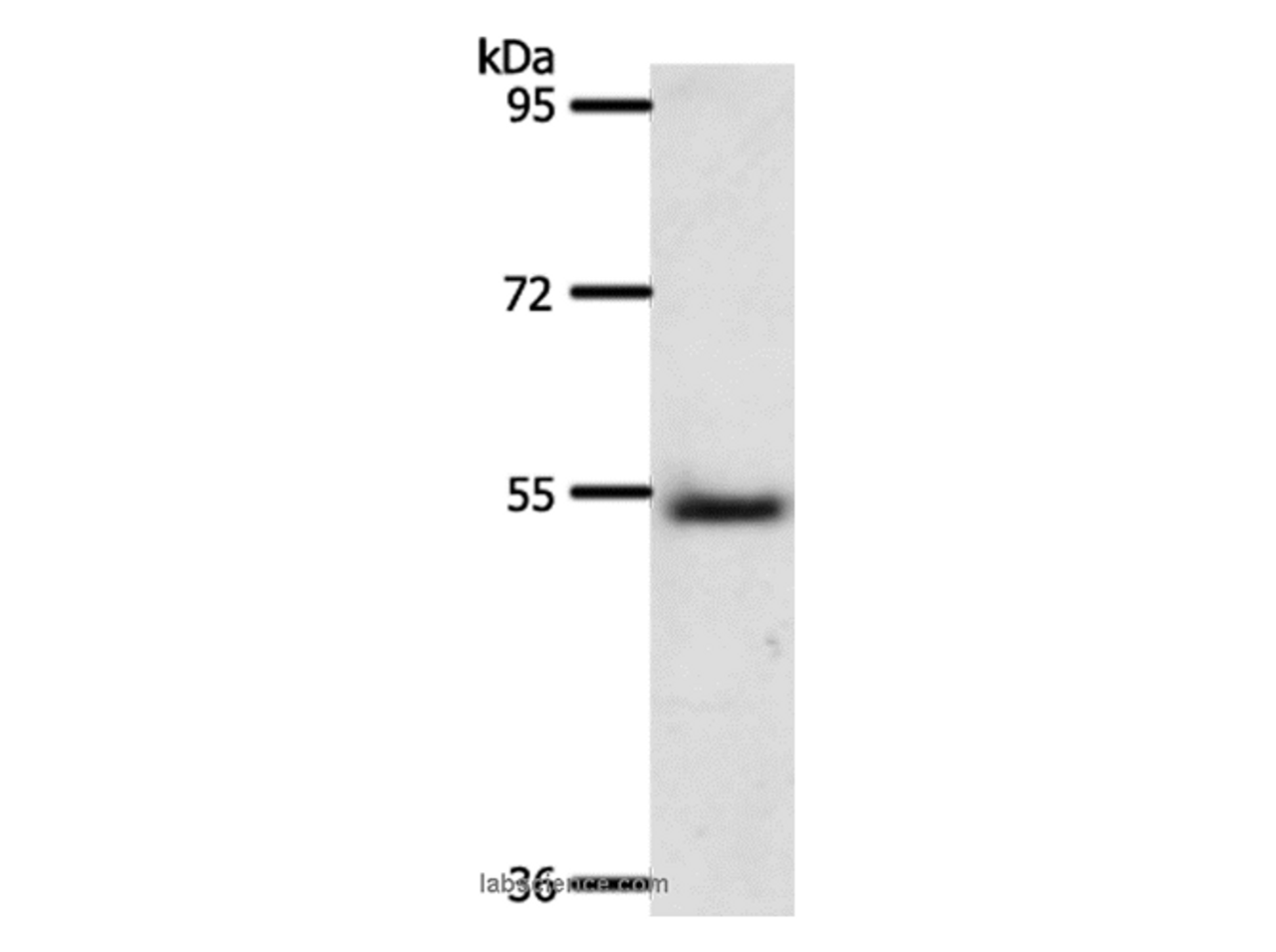 Western Blot analysis of Human liver cancer tissue using A1BG Polyclonal Antibody at dilution of 1:500