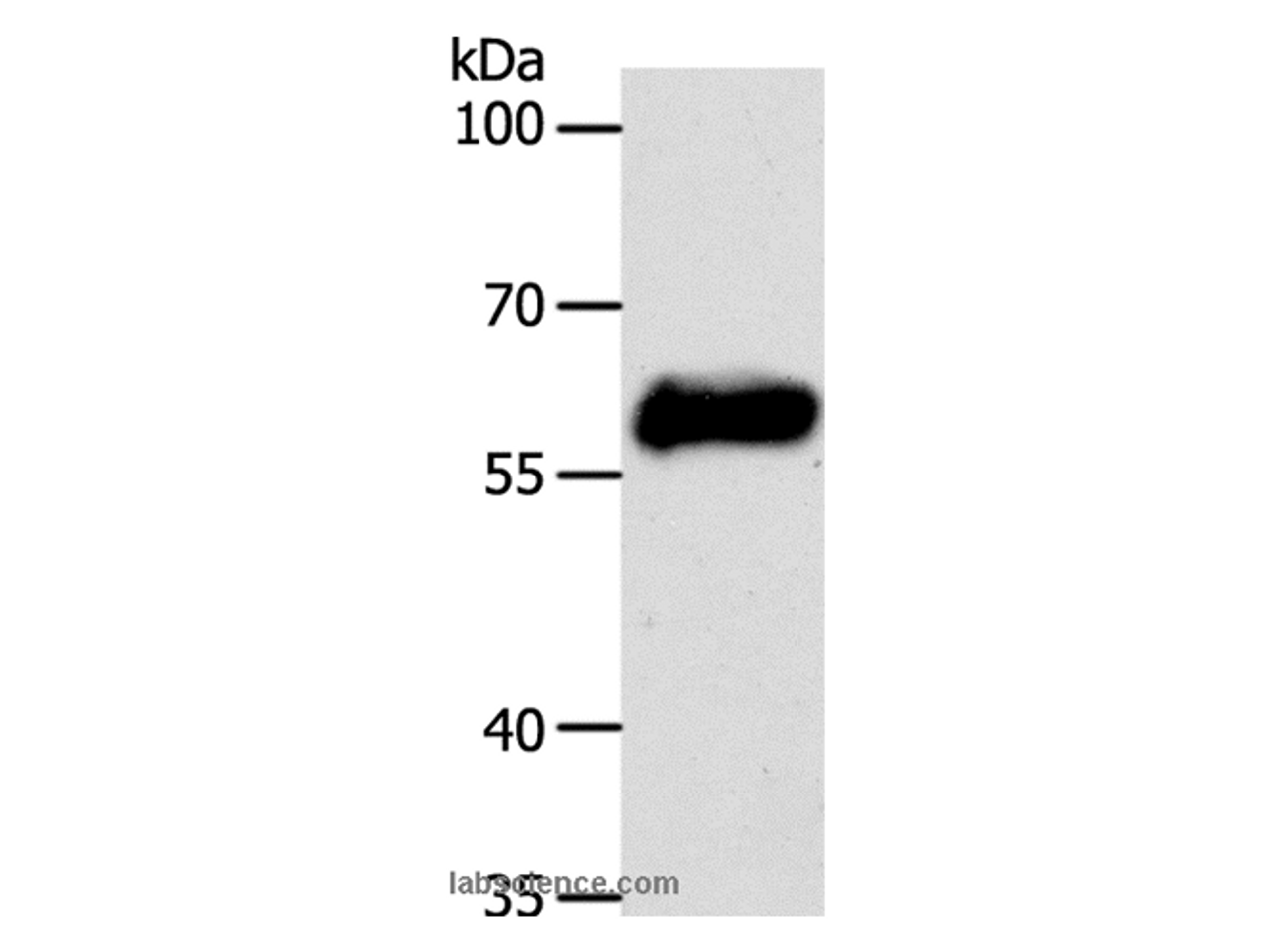 Western Blot analysis of MCF7 cell using CK-10 Polyclonal Antibody at dilution of 1:750