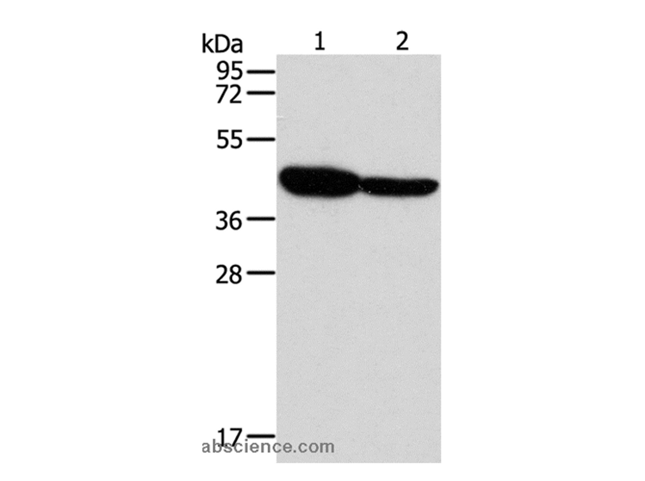 Western Blot analysis of Mouse brain and Human fetal brain tissue using GLRA1 Polyclonal Antibody at dilution of 1:500