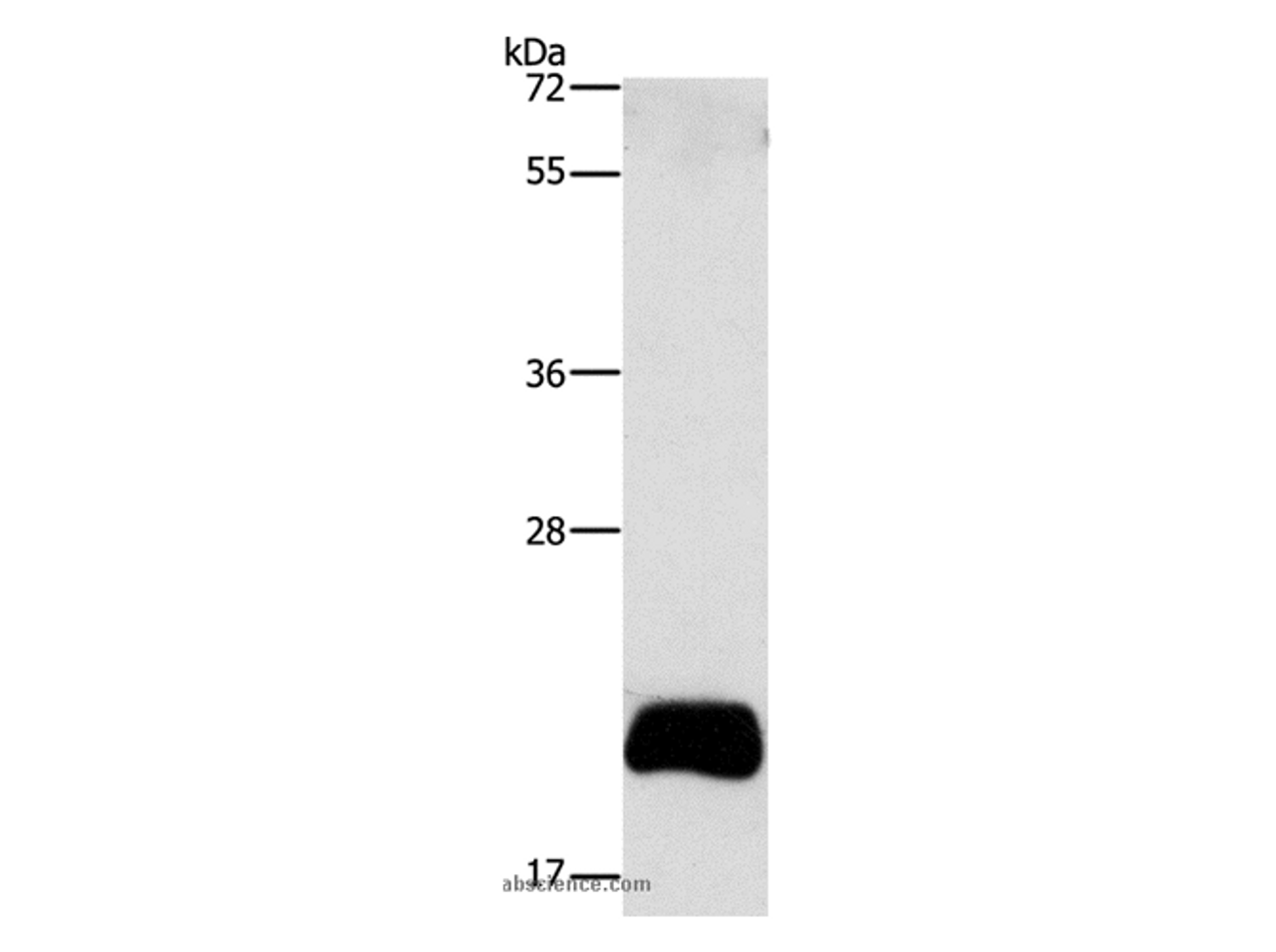 Western Blot analysis of PC3 cell using APOBEC3C Polyclonal Antibody at dilution of 1:420