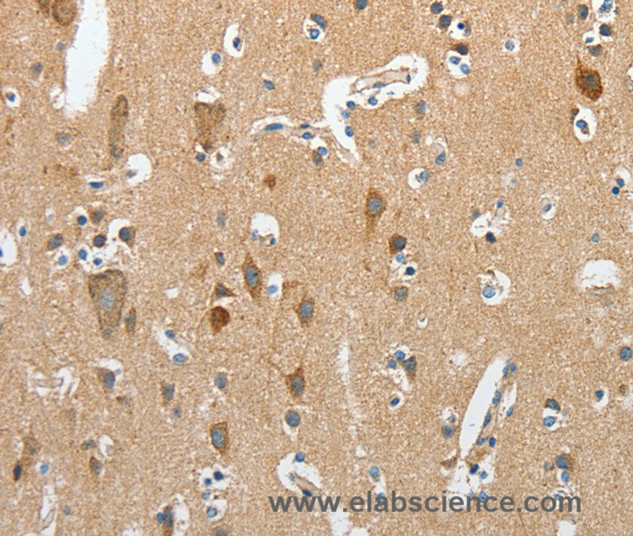 Immunohistochemistry of paraffin-embedded Human brain  using DSCR1 Polyclonal Antibody at dilution of 1:45