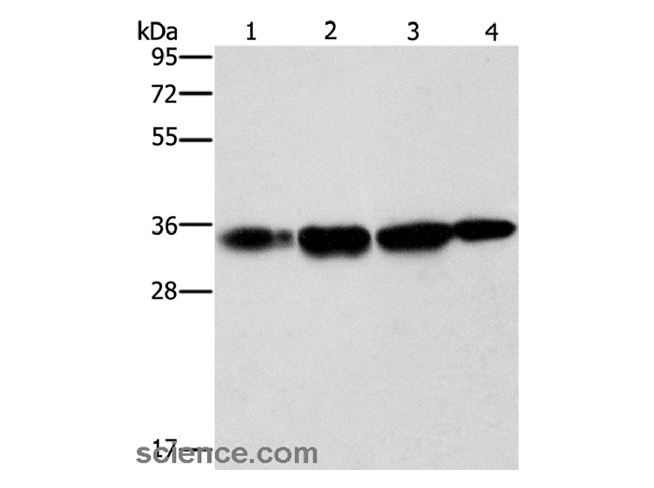 Western Blot analysis of Hela cell and Human prostate tissue, A172 cell and Mouse liver tissue using NSMCE3 Polyclonal Antibody at dilution of 1:1500