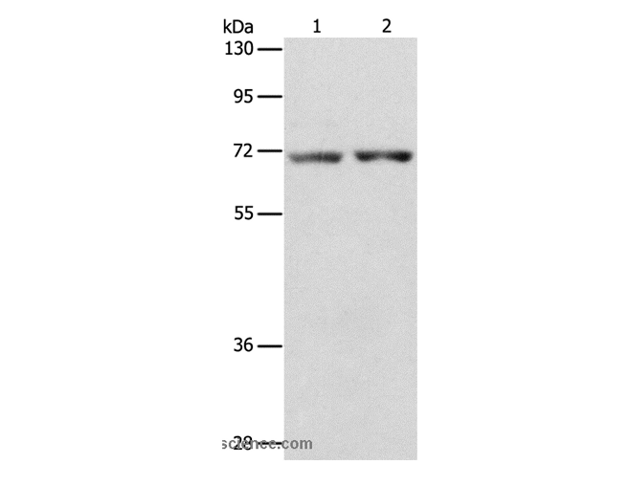 Western Blot analysis of Human liver cancer and colon cancer tissue using STK39 Polyclonal Antibody at dilution of 1:800