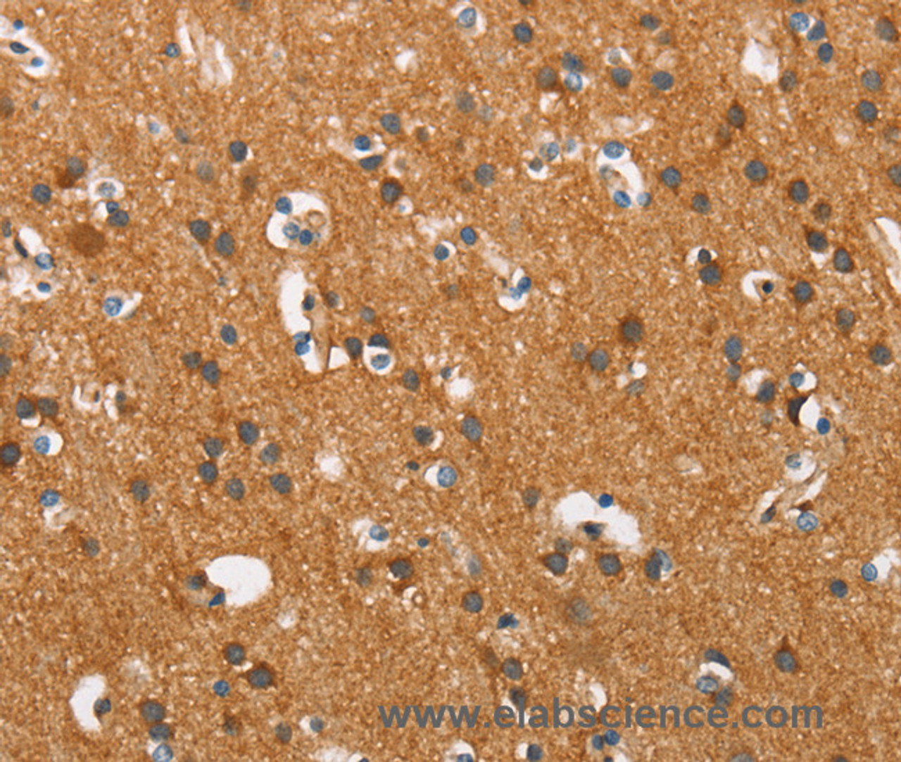 Immunohistochemistry of paraffin-embedded Human brain tissue using COX5A Polyclonal Antibody at dilution 1:40