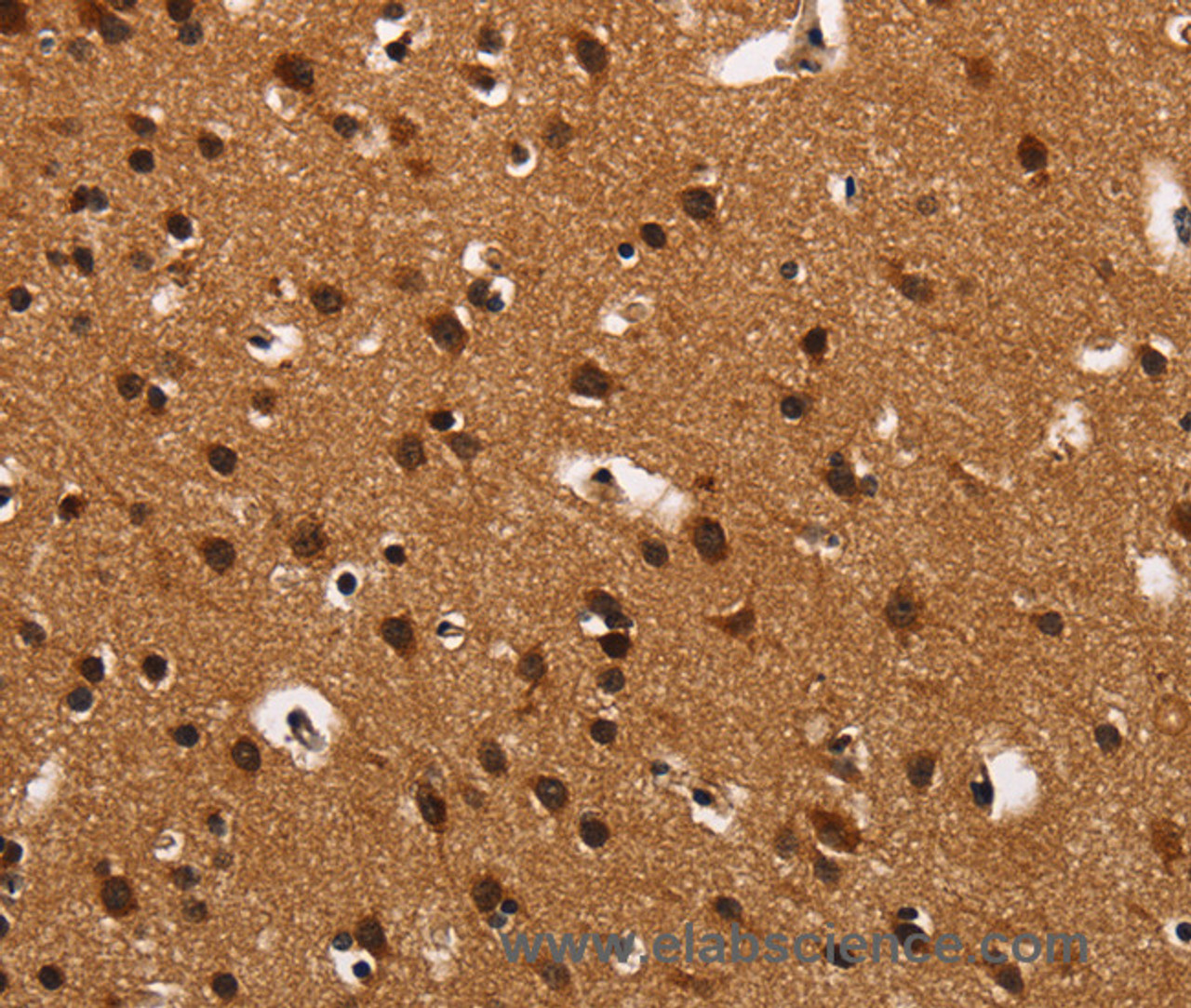 Immunohistochemistry of paraffin-embedded Human brain  tissue using ARSB Polyclonal Antibody at dilution 1:50