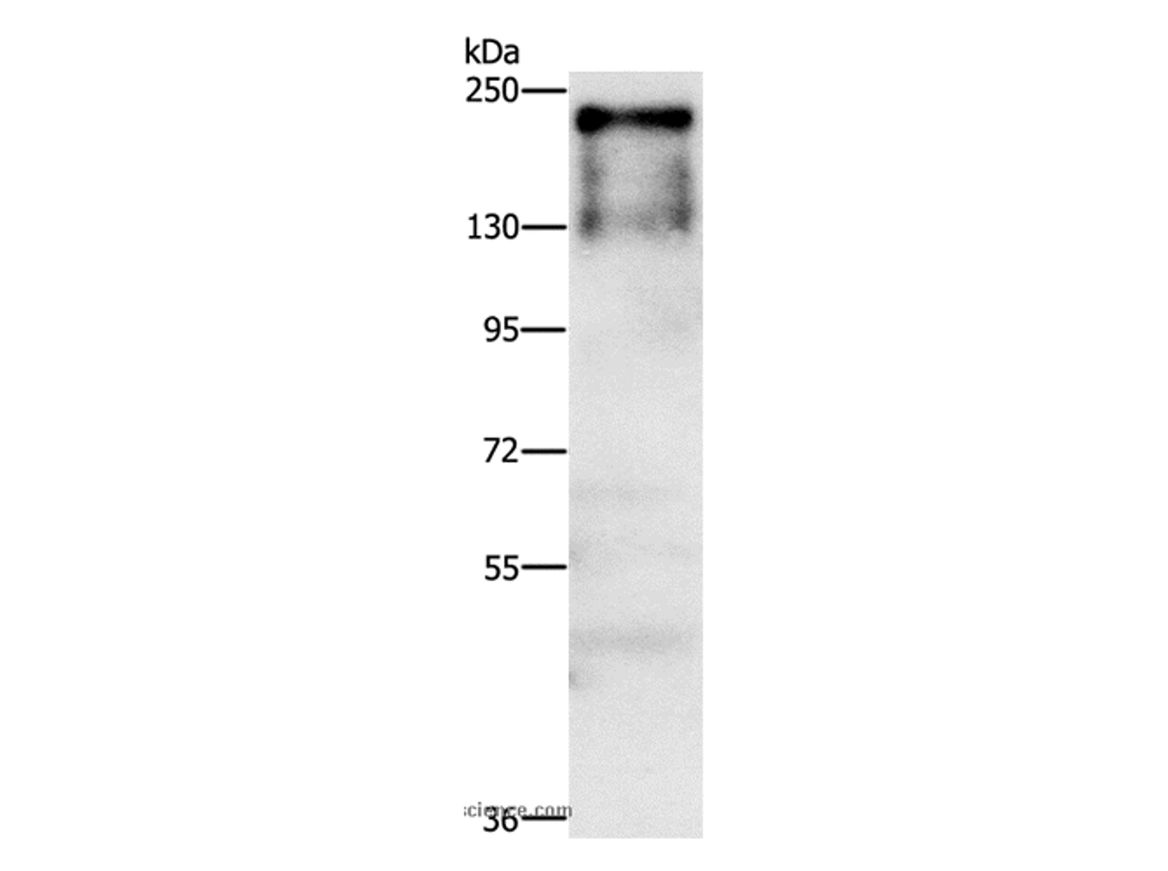 Western Blot analysis of A431 cell using ATAD5 Polyclonal Antibody at dilution of 1:750