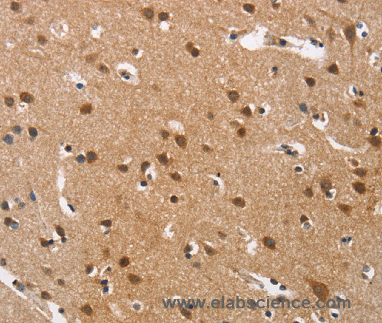 Immunohistochemistry of paraffin-embedded Human brain tissue using Cav1.3 Polyclonal Antibody at dilution 1:40