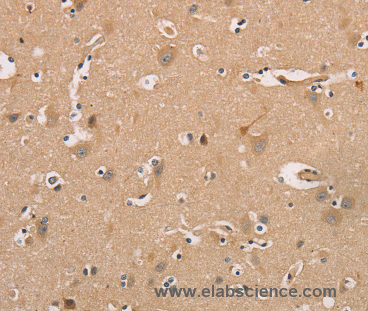 Immunohistochemistry of paraffin-embedded Human brain tissue using CDK11A/B Polyclonal Antibody at dilution 1:50
