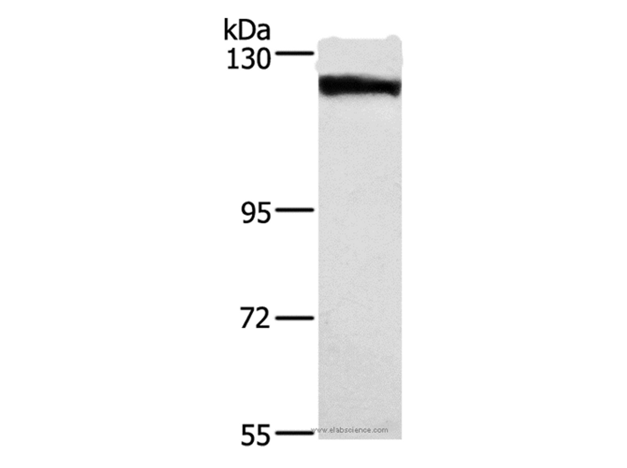 Western Blot analysis of Human tongue cancer tissue using DSG1 Polyclonal Antibody at dilution of 1:750