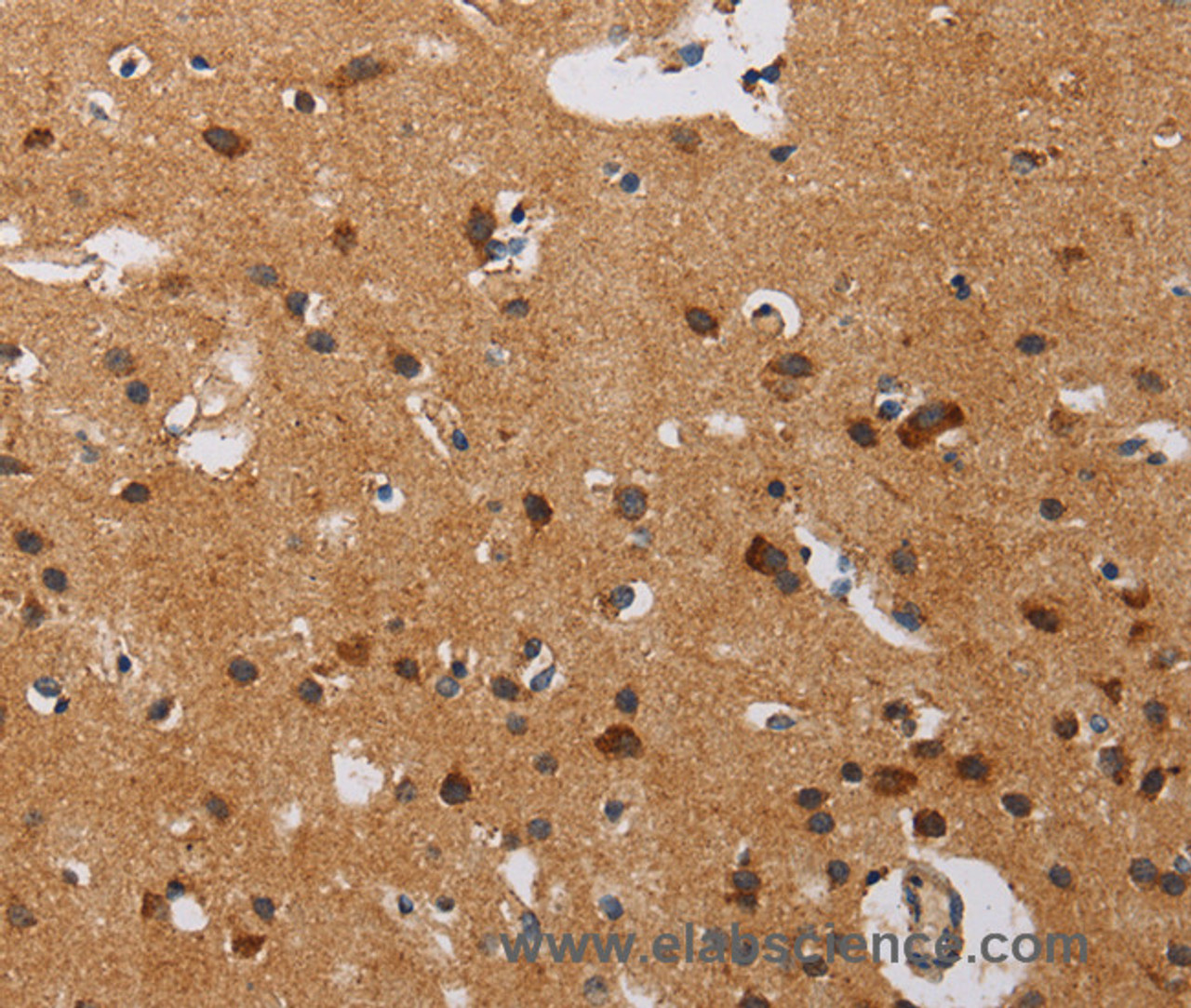 Immunohistochemistry of paraffin-embedded Human brain  using IL17RA Polyclonal Antibody at dilution of 1:40