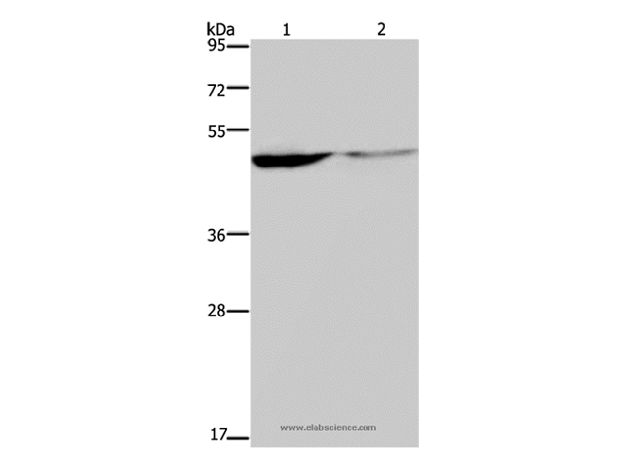 Western Blot analysis of Human paraneoplastic and normal kidney tissue   using KCNK9 Polyclonal Antibody at dilution of 1:650