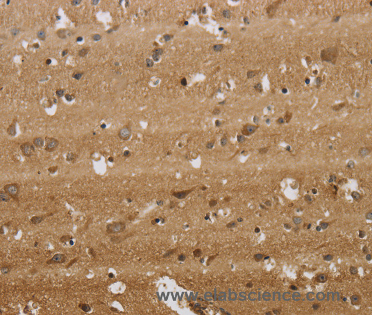Immunohistochemistry of paraffin-embedded Human brain  tissue using KCNMB2 Polyclonal Antibody at dilution 1:40
