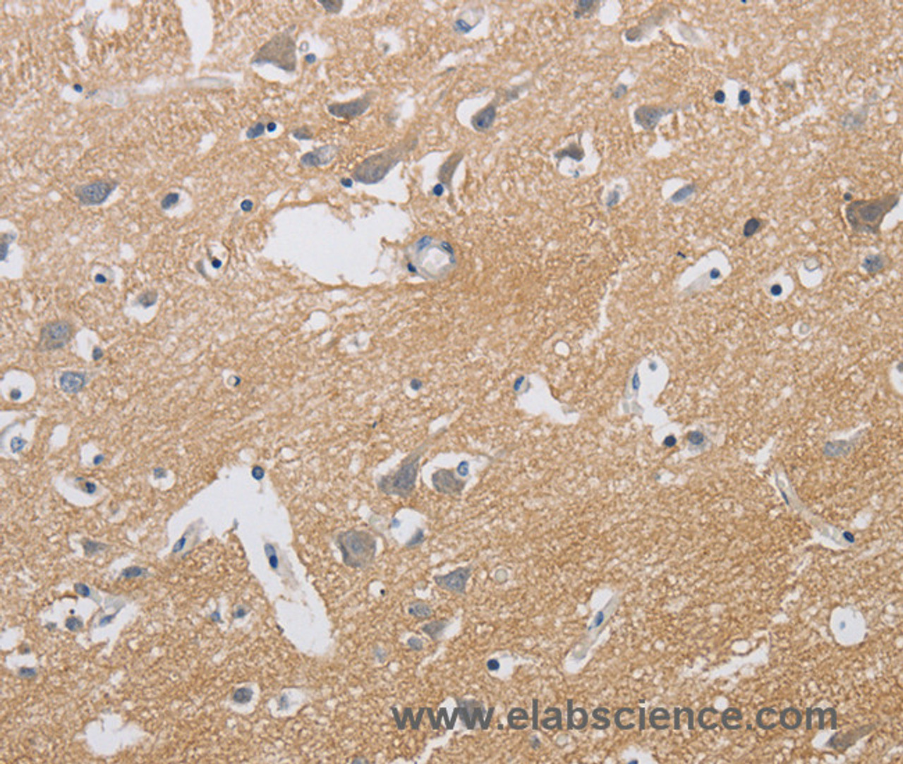 Immunohistochemistry of paraffin-embedded Human brain using KCNMB3 Polyclonal Antibody at dilution of 1:40