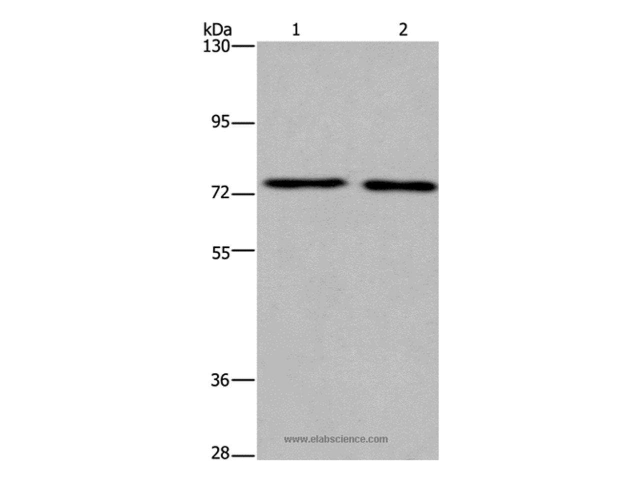 Western Blot analysis of Human fetal brain and Mouse brain tissue using KCNQ4 Polyclonal Antibody at dilution of 1:200