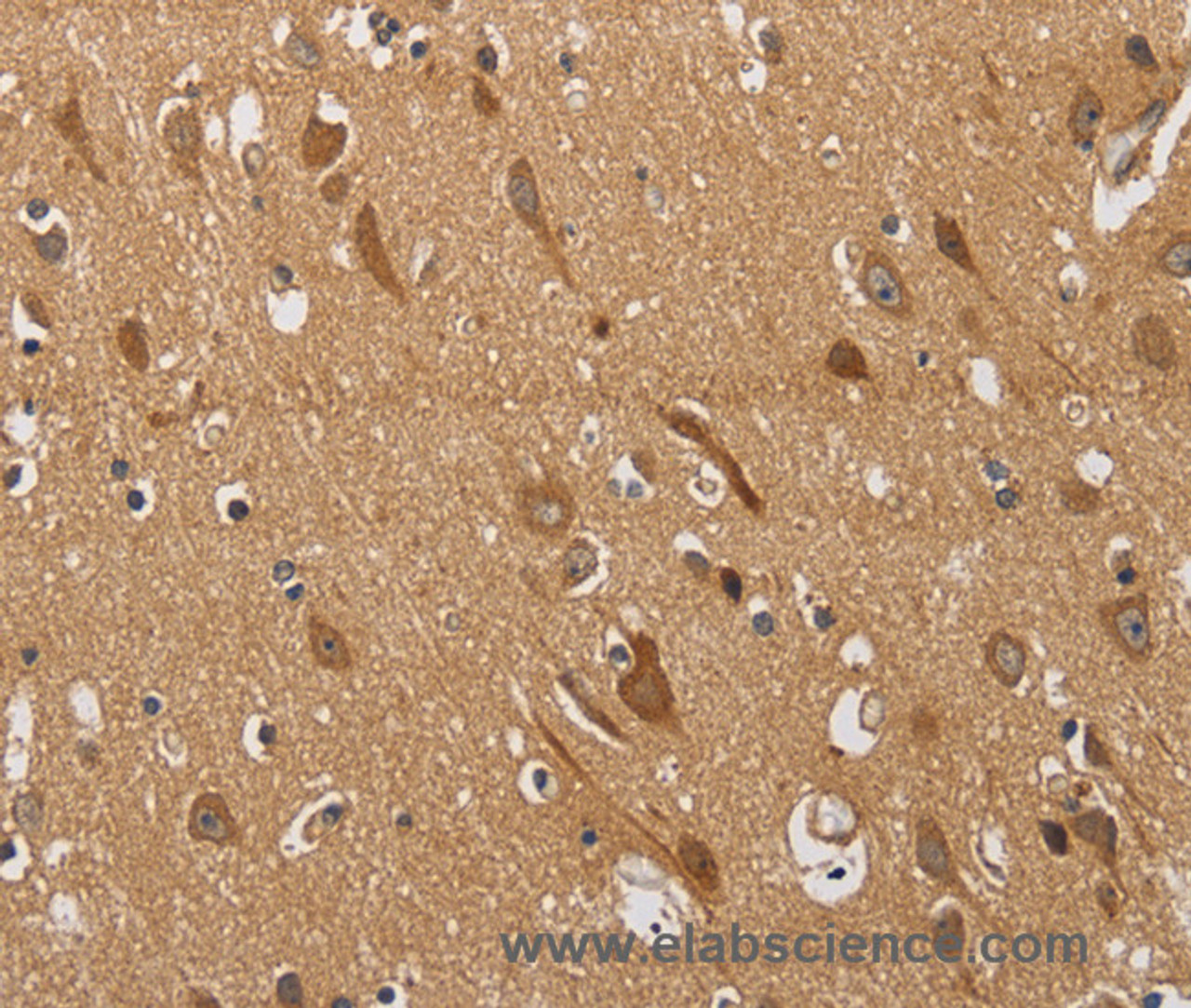 Immunohistochemistry of paraffin-embedded Human brain  using KCNQ4 Polyclonal Antibody at dilution of 1:40