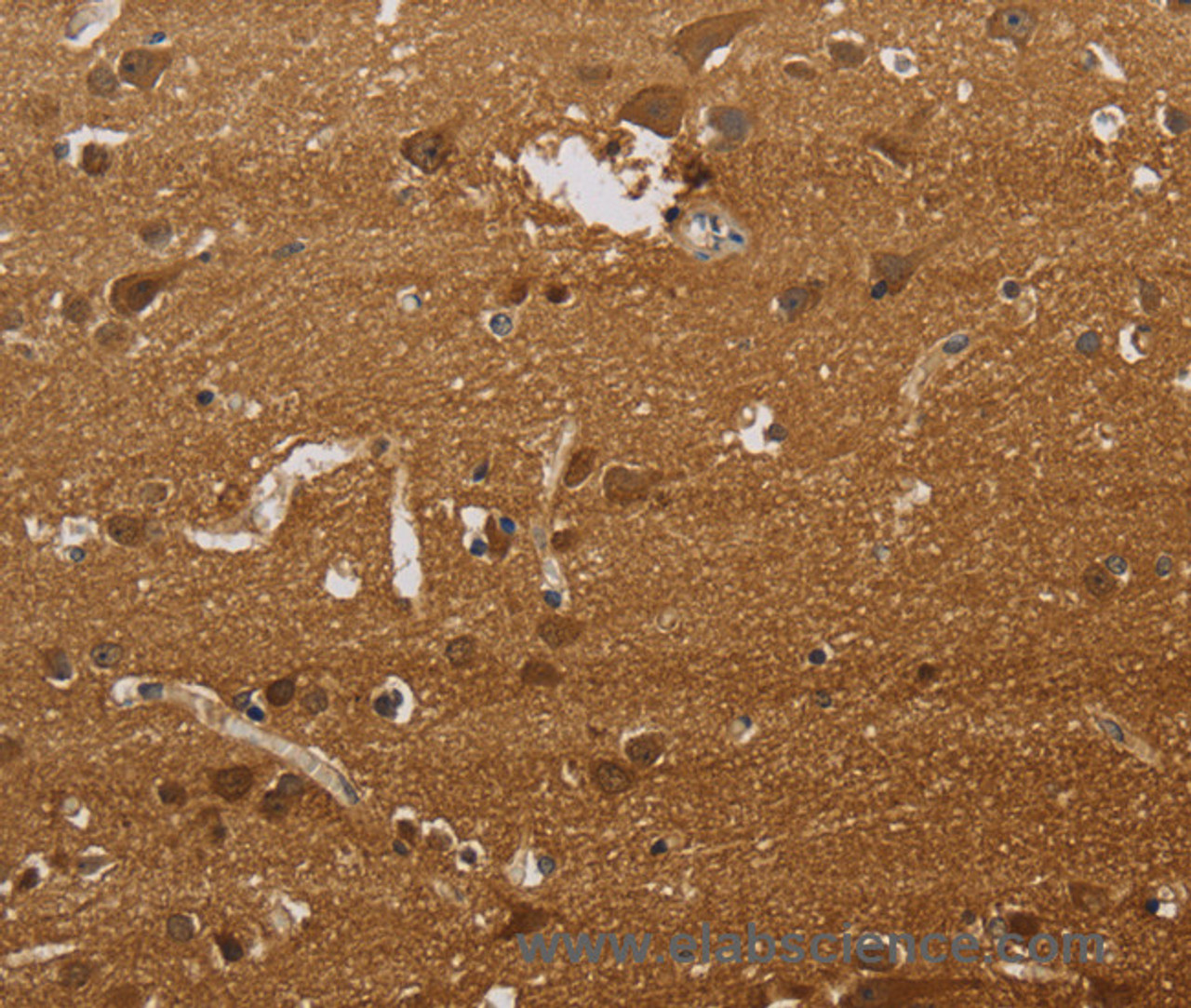 Immunohistochemistry of paraffin-embedded Human brain tissue using ELAVL2 Polyclonal Antibody at dilution 1:40