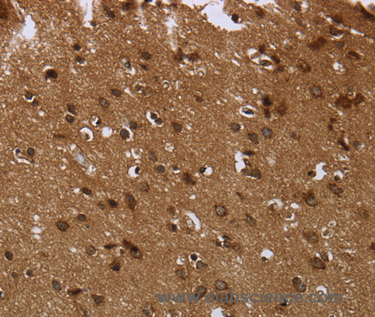 Immunohistochemistry of paraffin-embedded Human brain  tissue using CERS6 Polyclonal Antibody at dilution 1:35