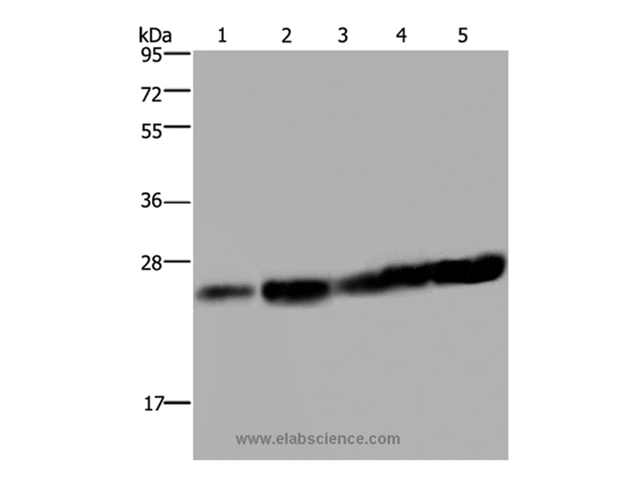 Western Blot analysis of Hela and Jurkat cell, Mouse liver tissue, K562 and A375 cell using MOB1A Polyclonal Antibody at dilution of 1:200