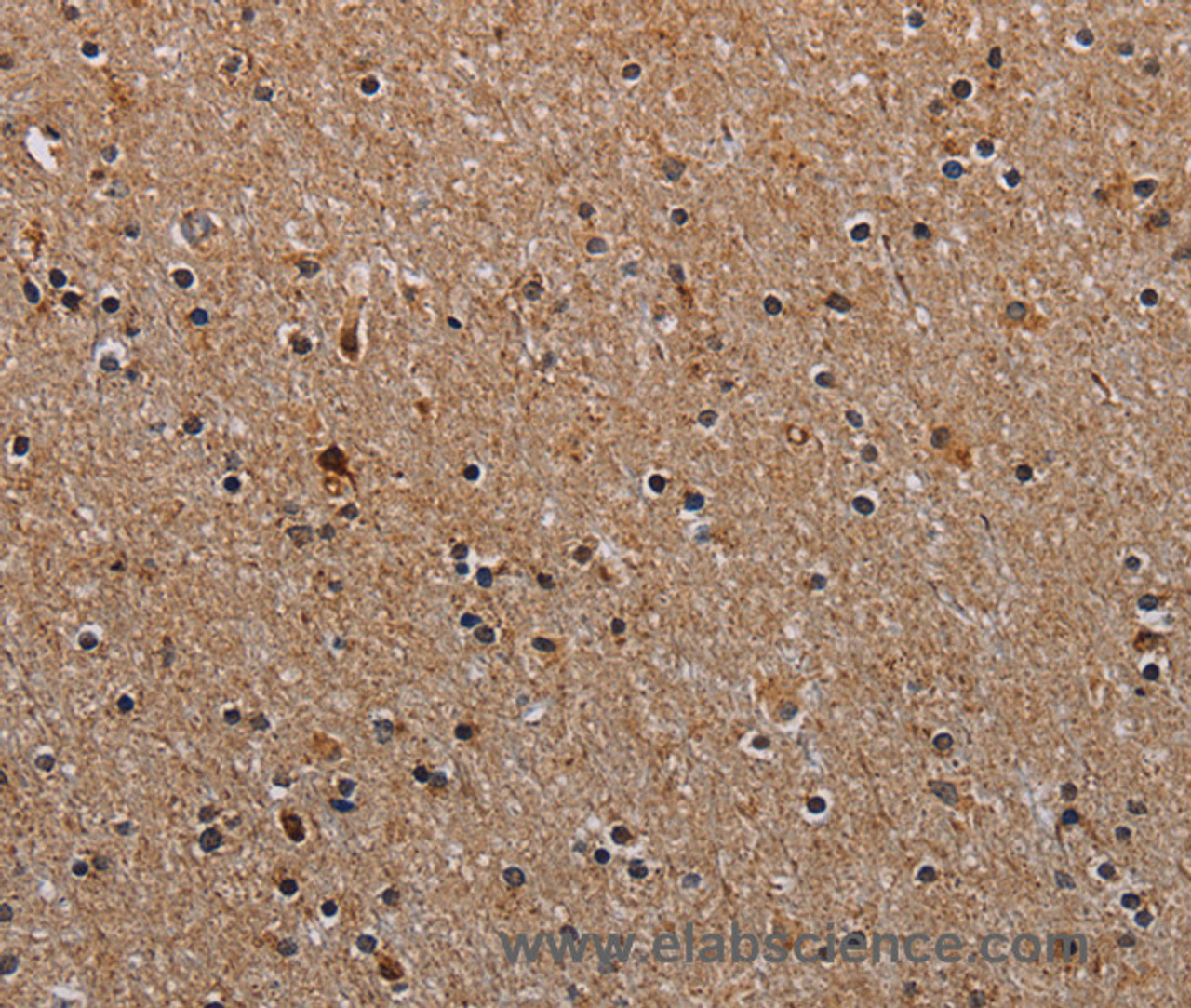 Immunohistochemistry of paraffin-embedded Human brain  using NDUFA8 Polyclonal Antibody at dilution of 1:40