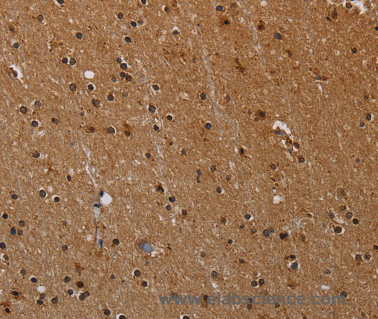 Immunohistochemistry of paraffin-embedded Human brain  tissue using PARP8 Polyclonal Antibody at dilution 1:40