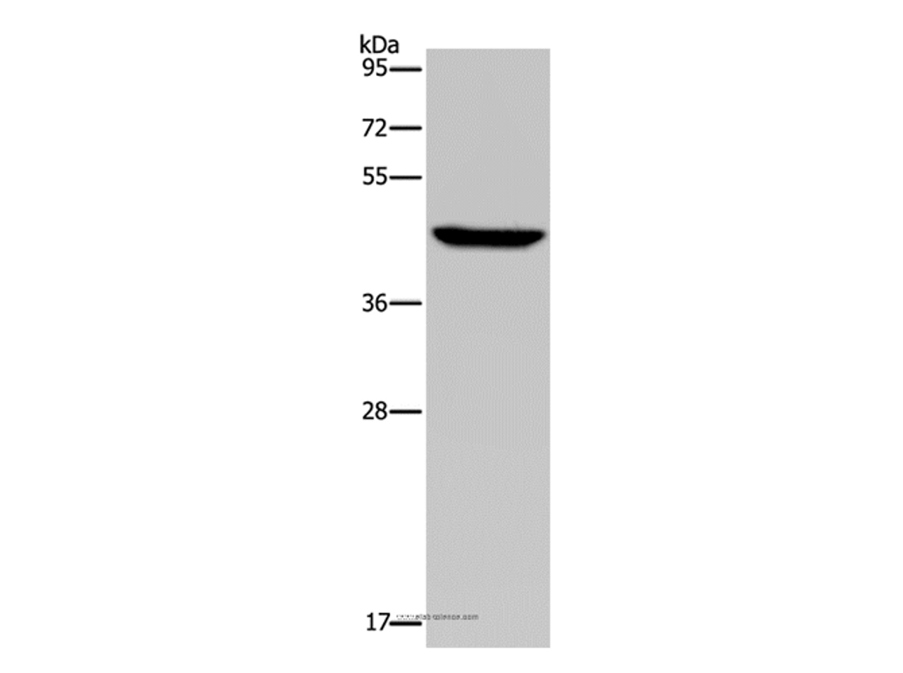 Western Blot analysis of Hela cell using PDSS2 Polyclonal Antibody at dilution of 1:400