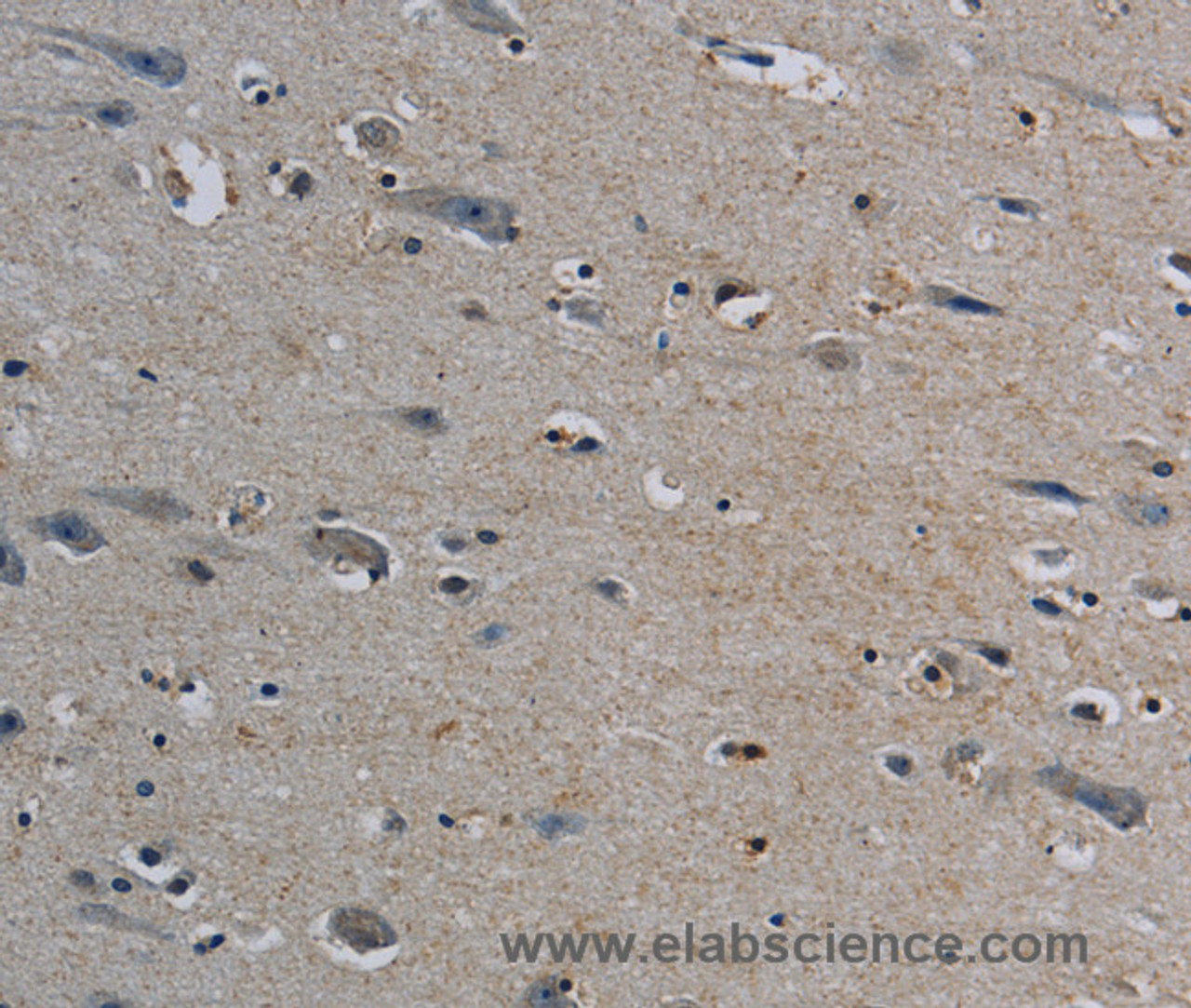 Immunohistochemistry of paraffin-embedded Human brain tissue using PERK Polyclonal Antibody at dilution 1:50