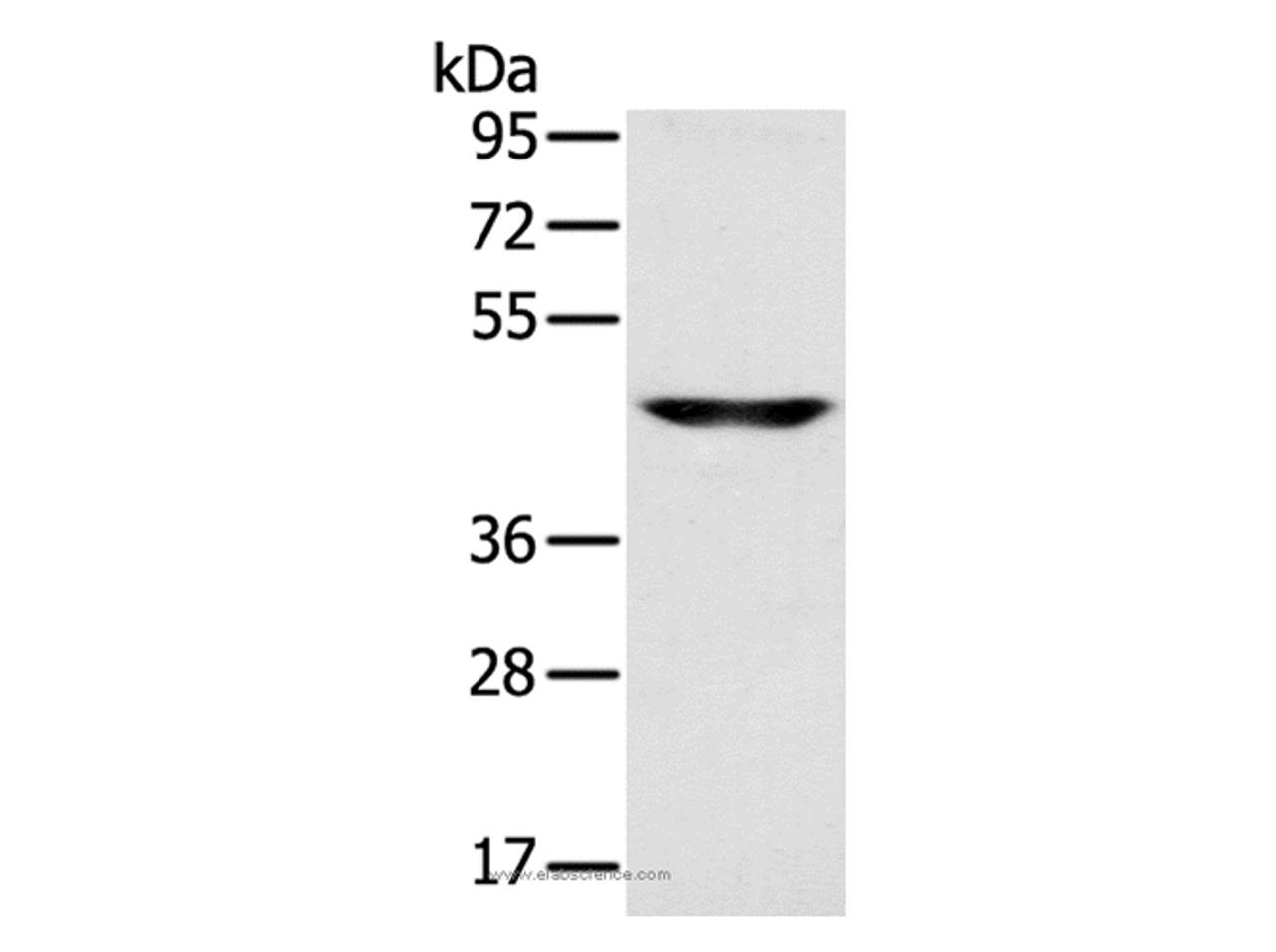 Western Blot analysis of Human fetal brain tissue using SLC16A8 Polyclonal Antibody at dilution of 1:200