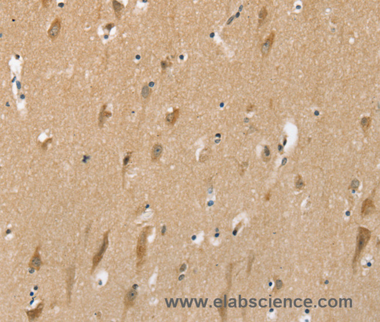 Immunohistochemistry of paraffin-embedded Human brain tissue using SLC6A7 Polyclonal Antibody at dilution 1:30
