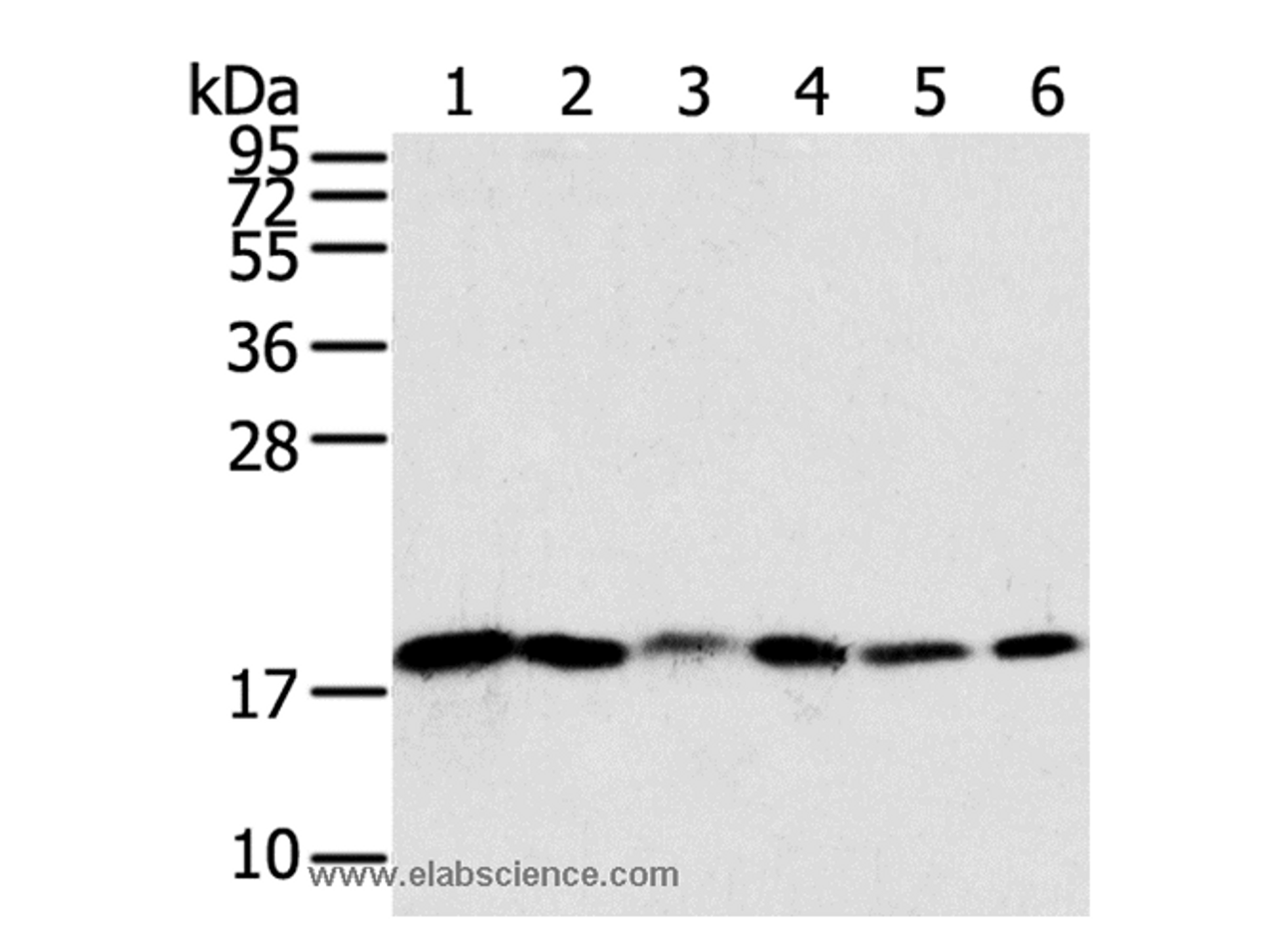 Western Blot analysis of Human colon sigmoideum cancer and colon cancer tissue, Mouse lung and Human normal colon tissue, lovo and hela cell using SNX3 Polyclonal Antibody at dilution of 1:250