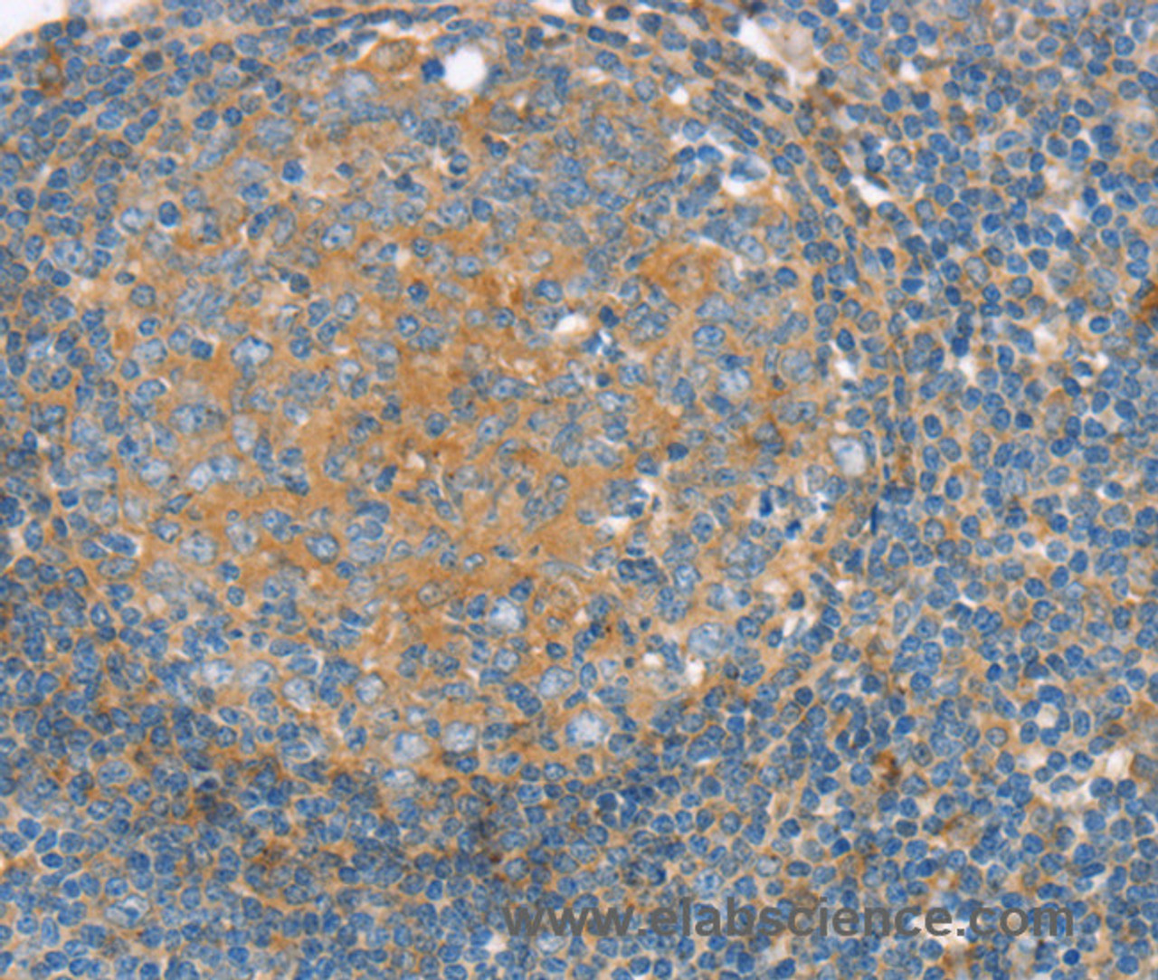 Immunohistochemistry of paraffin-embedded Human tonsil using SNX3 Polyclonal Antibody at dilution of 1:30