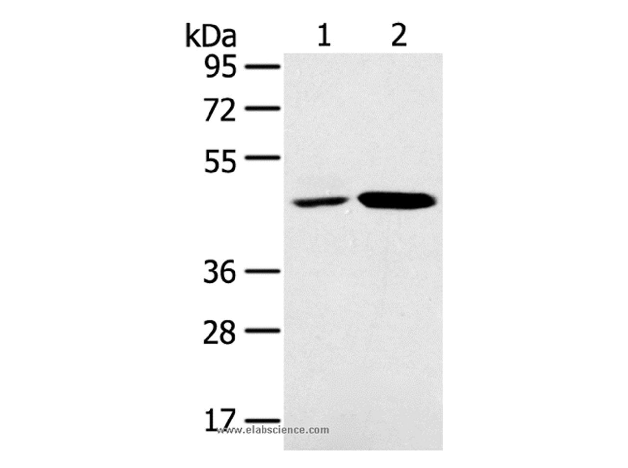 Western Blot analysis of K562 and Jurkat cell using SNX5 Polyclonal Antibody at dilution of 1:250