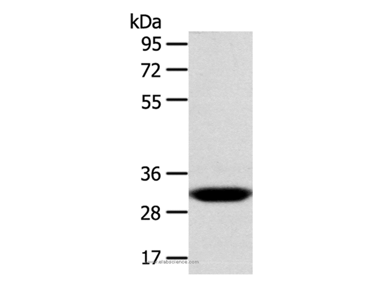 Western Blot analysis of Human fetal liver tissue using CCS Polyclonal Antibody at dilution of 1:300