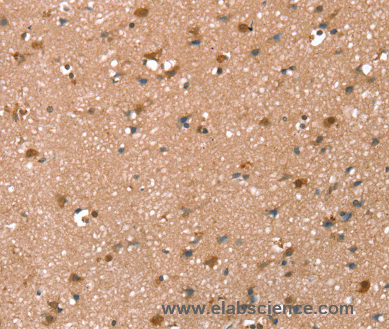 Immunohistochemistry of paraffin-embedded Human brain tissue using SYNPO2 Polyclonal Antibody at dilution 1:50