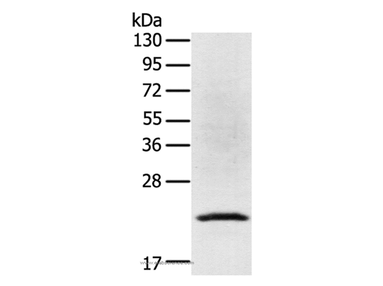 Western Blot analysis of Jurkat cell using TP53I11 Polyclonal Antibody at dilution of 1:400