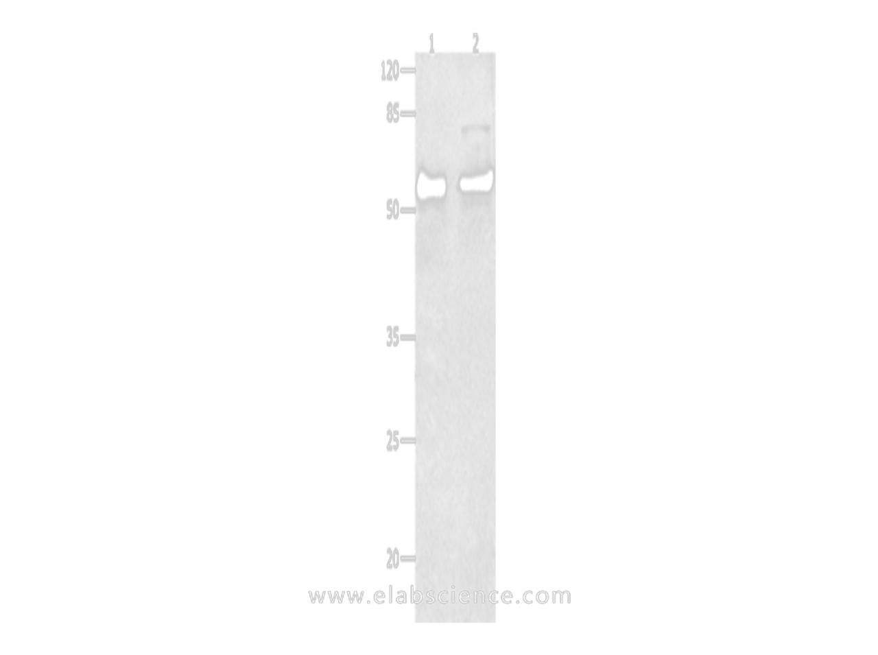 Western Blot analysis of Human liver cancer tissue and Hela cells using SMAD4 Polyclonal Antibody at dilution of 1:150