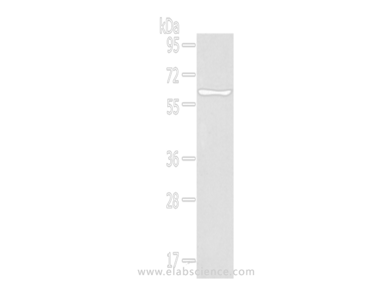 Western Blot analysis of Jurkat cells using GLP2R Polyclonal Antibody at dilution of 1:400