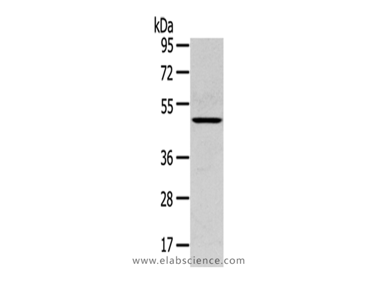 Western Blot analysis of Mouse lung tissue using SERPINB11 Polyclonal Antibody at dilution of 1/400
