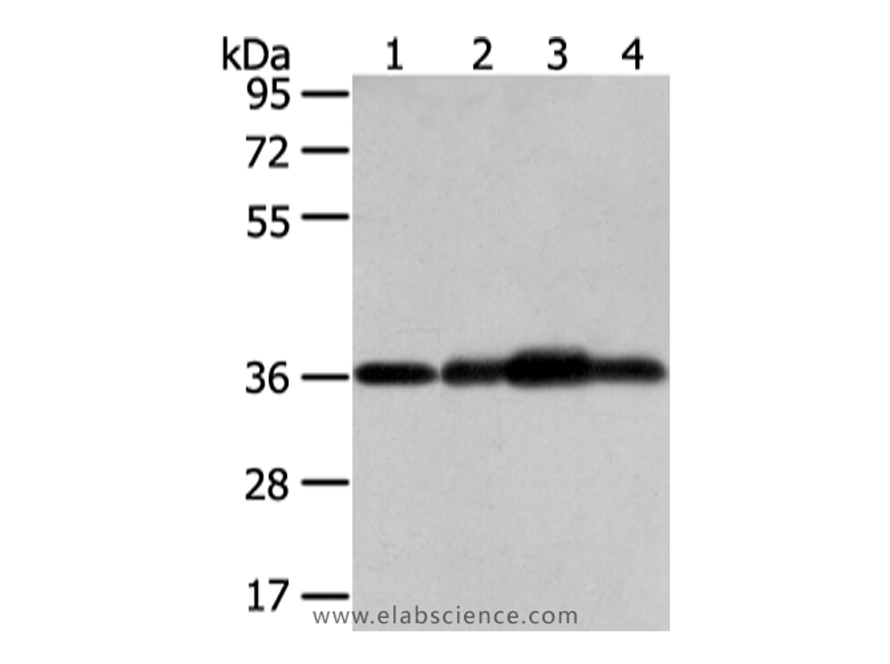 Western Blot analysis of Mouse brain tissue, hepg2, 293T and 231 cell using STX12 Polyclonal Antibody at dilution of 1/800